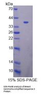 Human Breast Carcinoma Amplified Sequence 3 (BCAS3) Protein