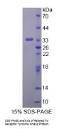 Human Related To Receptor Tyrosine Kinase (RYK) Protein