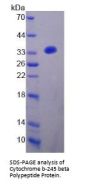 Human Cytochrome B-245 Heavy Chain (CYBB) Protein