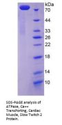 Human ATPase, Ca++ Transporting, Cardiac Muscle, Slow Twitch 2 (ATP2A2) Protein