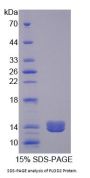 Human Procollagen Lysine-2-Oxoglutarate-5-Dioxygenase 2 (PLOD2) Protein
