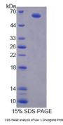 Human Proto-Oncogene Vav (VAV1) Protein
