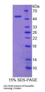 Human Pescadillo Homolog 1 (PES1) Protein