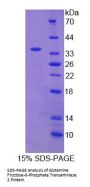 Human Glutamine Fructose-6-Phosphate Transaminase 2 (GFPT2) Protein