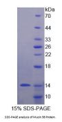Human Mucin-3B (MUC3B) Protein