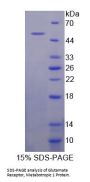 Human Glutamate Receptor, Metabotropic 1 (GRM1) Protein