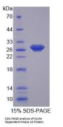 Human Cyclin Dependent Kinase 16 (CDK16) Protein