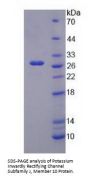 Human Potassium Inwardly Rectifying Channel Subfamily J, Member 10 (KCNJ10) Protein