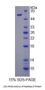 Human Peptidase D (PEPD) Protein