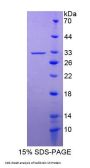 Human Kallikrein 13 (KLK13) Protein