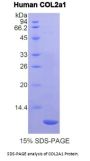 Human Collagen Type II Alpha 1 (COL2A1) Protein