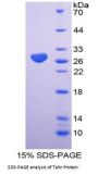 Human Talin (TLN) Protein