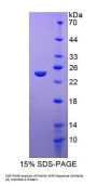 Human Family With Sequence Similarity 20, Member A (FAM20A) Protein