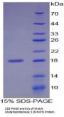 Human Matrix Metalloproteinase 3 / Stromelysin-1 (MMP3) Protein
