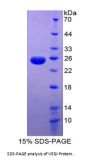 Human Tumor Necrosis Factor Ligand Superfamily Member 15 (TNFSF15) Protein