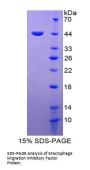Human Macrophage Migration Inhibitory Factor (MIF) Protein
