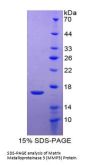 Human Matrix Metalloproteinase 3 / Stromelysin-1 (MMP3) Protein