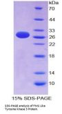 Human Receptor-type tyrosine-protein kinase FLT3 (FLT3) Protein