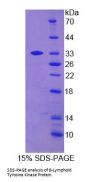 Human B-Lymphoid Tyrosine Kinase (BLK) Protein