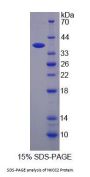 Human Na-K-Cl Cotransporter 2 (NKCC2) Protein