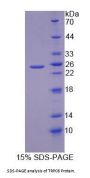 Human Transient Receptor Potential Cation Channel Subfamily C, Member 6 (TRPC6) Protein