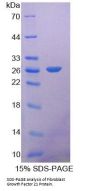 Human Fibroblast Growth Factor 21 (FGF21) Protein