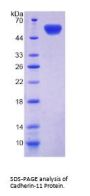 Human Cadherin-11 (CDH11) Protein