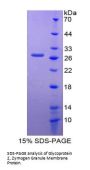 Human Pancreatic secretory granule membrane major glycoprotein GP2 (GP2) Protein