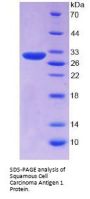 Human Squamous Cell Carcinoma Antigen 1 (SCCA1) Protein