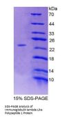 Human Immunoglobulin Lambda Like Polypeptide 1 (IGLL1) Protein