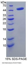 Human Adenosylhomocysteinase (AHCY) Protein