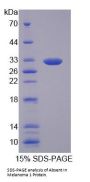 Human Absent In Melanoma 1 (AIM1) Protein