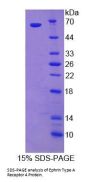 Human Ephrin Type A Receptor 4 (EPHA4) Protein