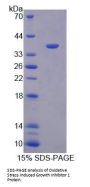 Human Oxidative Stress Induced Growth Inhibitor 1 (OSGIN1) Protein