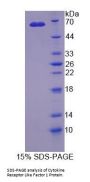 Human Cytokine Receptor Like Factor 1 (CRLF1) Protein