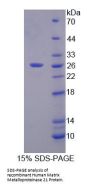 Human Matrix Metalloproteinase 21 (MMP21) Protein