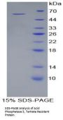 Human Tartrate-Resistant Acid Phosphatase 5 / TRACP5 (ACP5) Protein
