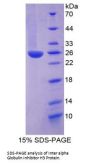 Human Inter Alpha-Globulin Inhibitor H3 (ITIH3) Protein