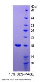 Human Neurotrophin 4 (NT4) Protein
