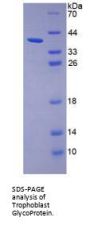 Human Trophoblast Glycoprotein (TPBG) Protein
