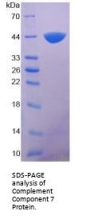 Human Complement C7 (C7) Protein