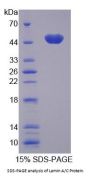 Human Lamin A/C (LMNA) Protein