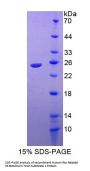 Human Ras Related C3 Botulinum Toxin Substrate 1 (RAC1) Protein