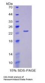 Human Hexosaminidase B Beta (HEXb) Protein