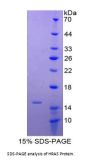 Human GTPase HRas (HRAS) Protein