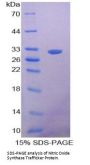 Human Nostrin (NOSTRIN) Protein