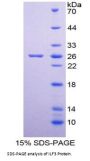 Human Interleukin Enhancer Binding Factor 3 (ILF3) Protein