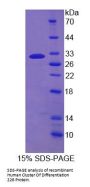 Human Cluster of Differentiation 226 (CD226) Protein