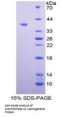 Human Polyunsaturated Fatty Acid Lipoxygenase ALOX12 (ALOX12) Protein