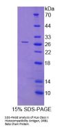Human HLA Class II Histocompatibility Antigen, DRB1 Beta Chain (HLA-DRB1) Protein